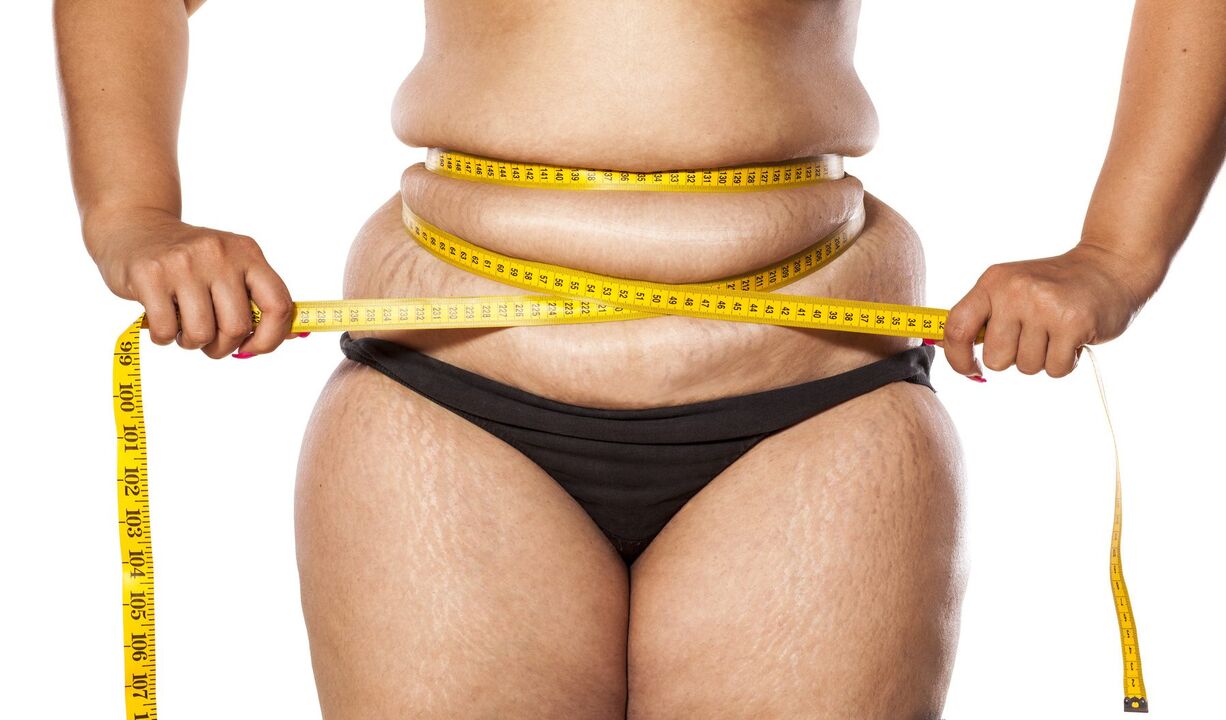 Overweight and weight loss using the probiotix keto